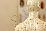 acupuncture