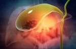 Gastro Surgeon in Jaipur