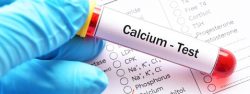 Calcium Test